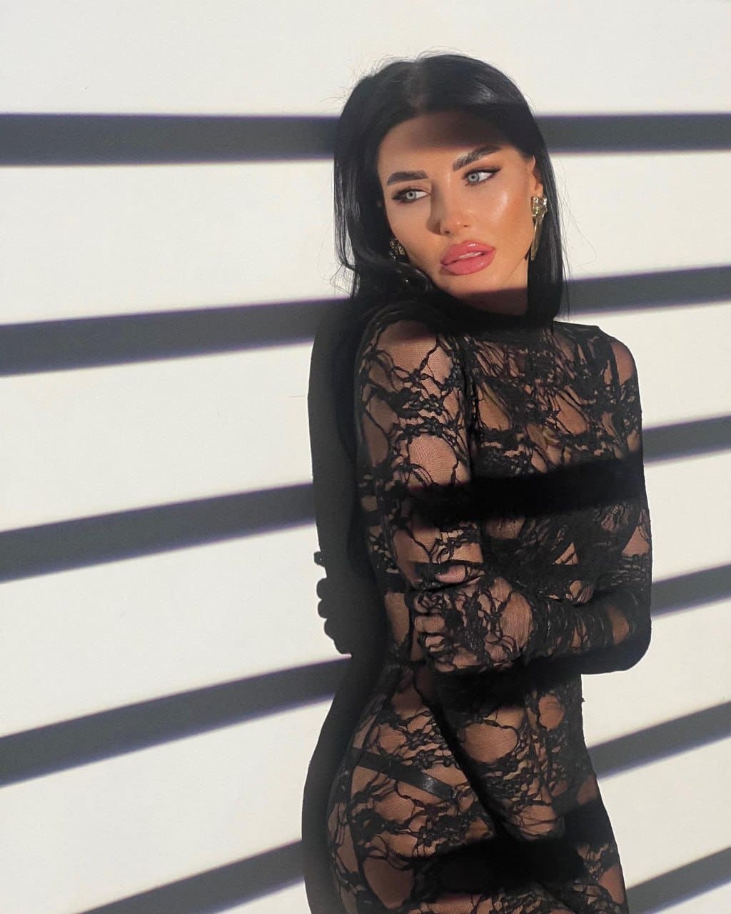 A woman in a long-sleeved black lace dress with a fur-trimmed waistband stands with crossed arms against a striped wall.